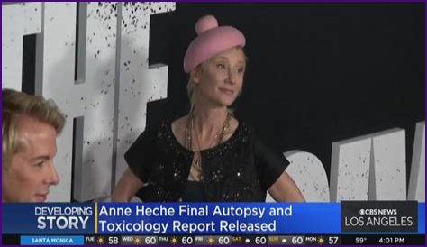 Autopsy of Anne Heche: Beloved Hollywood Actress
