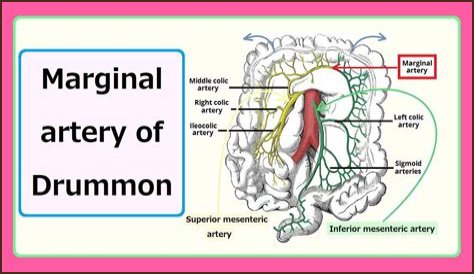 Marie Drummond's Diagnosis: What The Experts Say